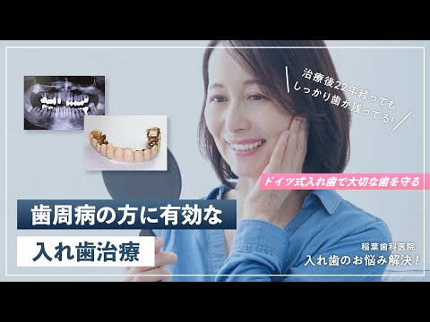 歯周病の方に有効な入れ歯治療