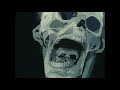 Alice In Chains Them Bones Slowed Reverb