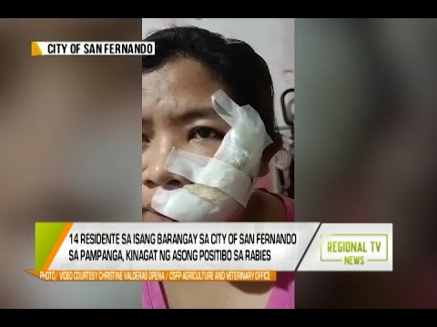 GMA Regional TV News: 14 Residente sa City of San Fernando sa Pampanga, Kinagat ng Aso