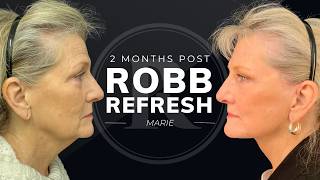 Marie's Story: 2 Months Post Facial Rejuvenation
