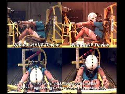 Hans Comparison Video