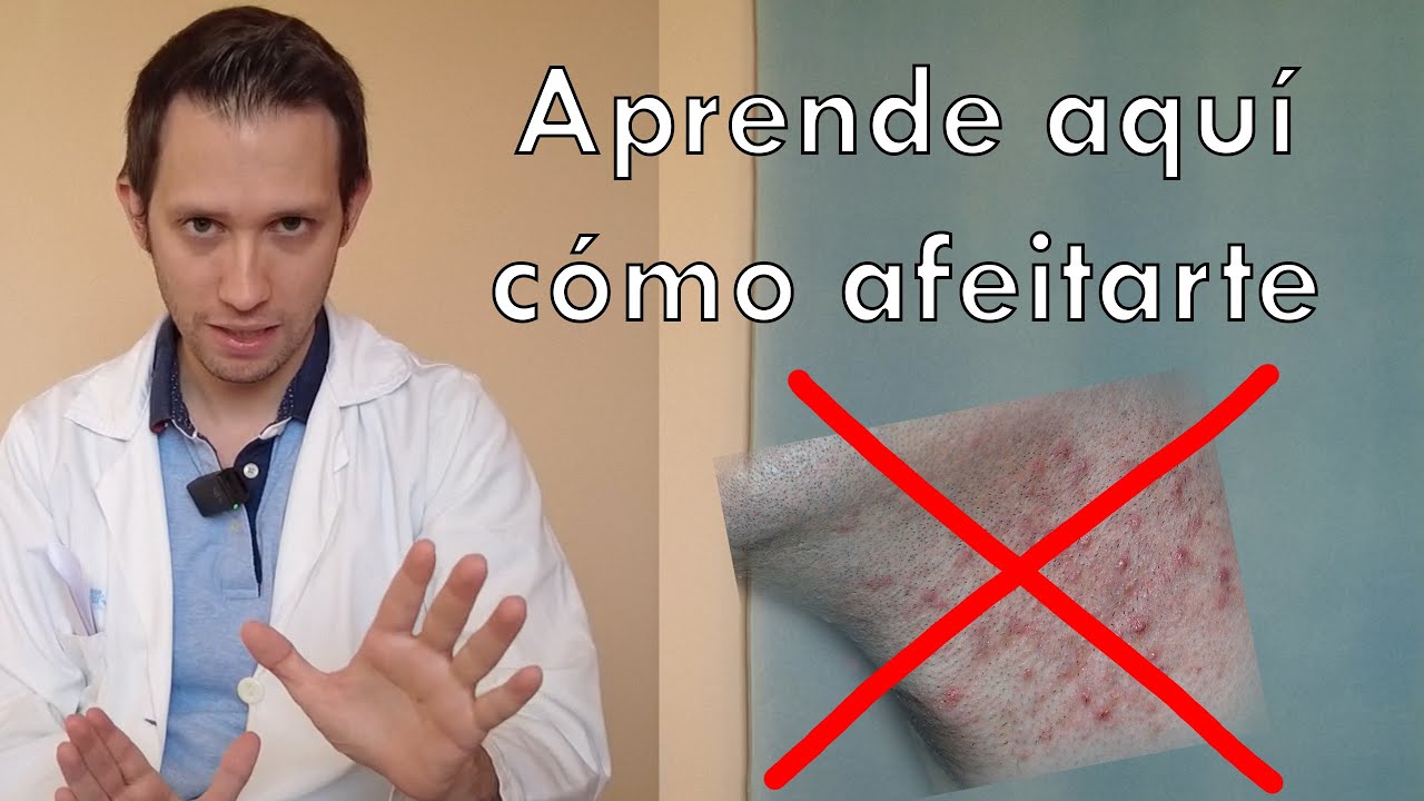 Watch Dermatólogo te explica cómo afeitarte y evitar granos Now Dermatólogo te explica cómo afeitarte y evitar granos