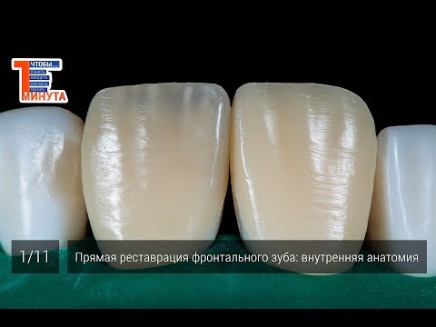 Прямая реставрация фронтального зуба: внутренняя анатомия