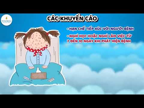 Cúm mùa - Dấu hiệu và cách phòng tránh