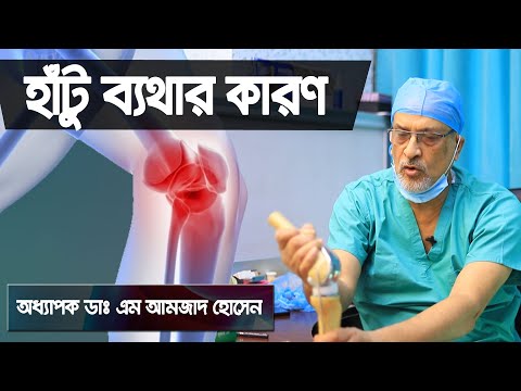 হাটুর ব্যাথা সারানোর উপায় | হাটুর ব্যাথা কেন হয় | how to cure knee pain