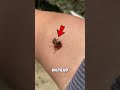 Bees can survive after they sting you