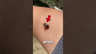 Bees can survive after they sting you