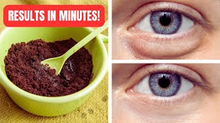 Tired of Looking Tired? This Will Erase Your Under-Eye Bags in Minutes!