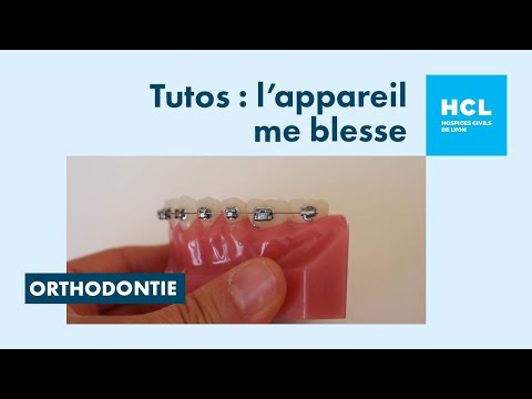Vidéo explicative