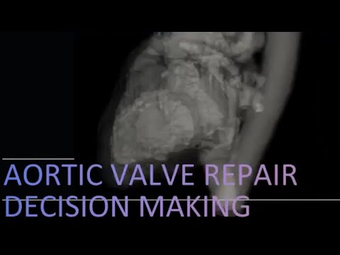 Multicentre Echo Teaching Series - Dr. Annette Vegas - AV Repair