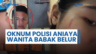 Tampang Bripda AA, Oknum Polisi di Jabar Aniaya Wanita hingga Babak Belur Gegara DM Instagram