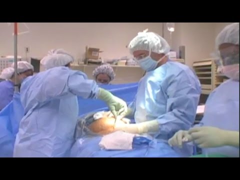 Na mawalan ng timbang sa Leslie Sansone Diyeta tabletas tulad ng fluoxetine