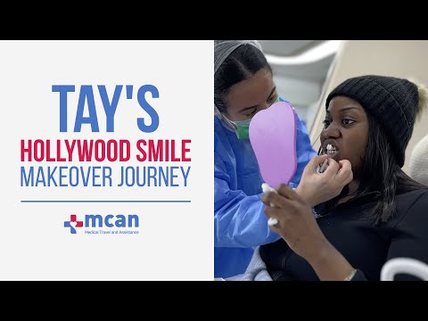 Tay's  Hollywood Smile Makeover Journey