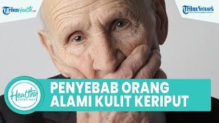 Penyebab Seseorang Alami Kulit Keriput, dari Paparan Sinar Matahari hingga Kebiasaan Merokok