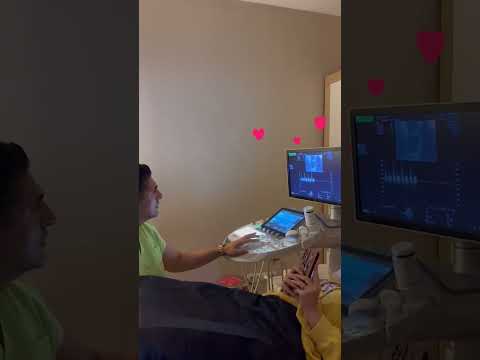 PCOS+Uterine Shape Abnormalities