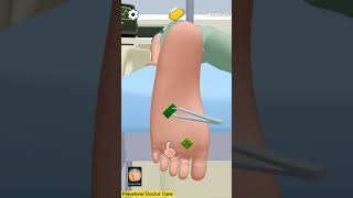 Stepped on Lego 🙄😑😓 (Doctor Care!) 👨‍⚕️🏥