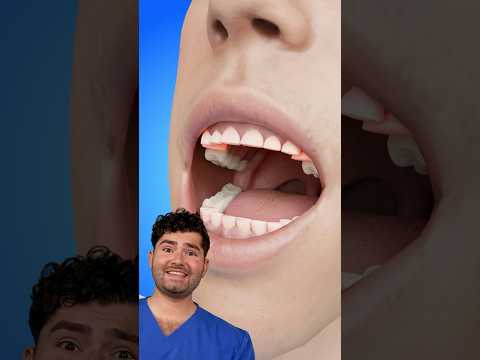 How to Fix Teeth!?