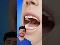 How To Fix Teeth