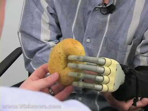 Jak vypadá a funguje bionická ruka?
