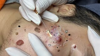 𝘚ℎ𝘢𝑟𝘦 𝘵𝑖𝘱𝑠 𝑓𝘰𝑟 𝑐𝘭𝑒𝘢𝑛𝘪𝑛𝘨 𝘢𝑛𝘥 𝘵𝑎𝘬𝑖𝘯𝑔 𝑐𝘢𝑟𝘦 𝘰𝑓 𝑦𝘰𝑢𝘳 𝘧𝑎𝘤𝑒 #35