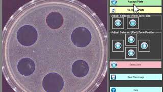 USP 81 Antibiotic Assay Zone Reader - TRINITY V3