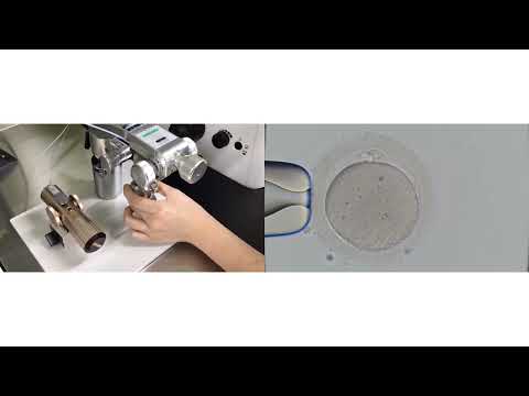 オステオピラス・ドミニセンシスについて詳しく解説