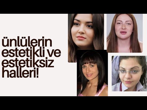 Miracle of Aesthetics: Celebrities Before and After! 🧖‍♀️✨