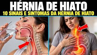 Assista Isso: 10 sinais e sintomas de hérnia de hiato que você precisa conhecer!