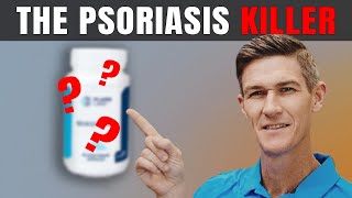 Best Supplement for Psoriasis Treatment | How to Get Rid of Psoriasis Naturally