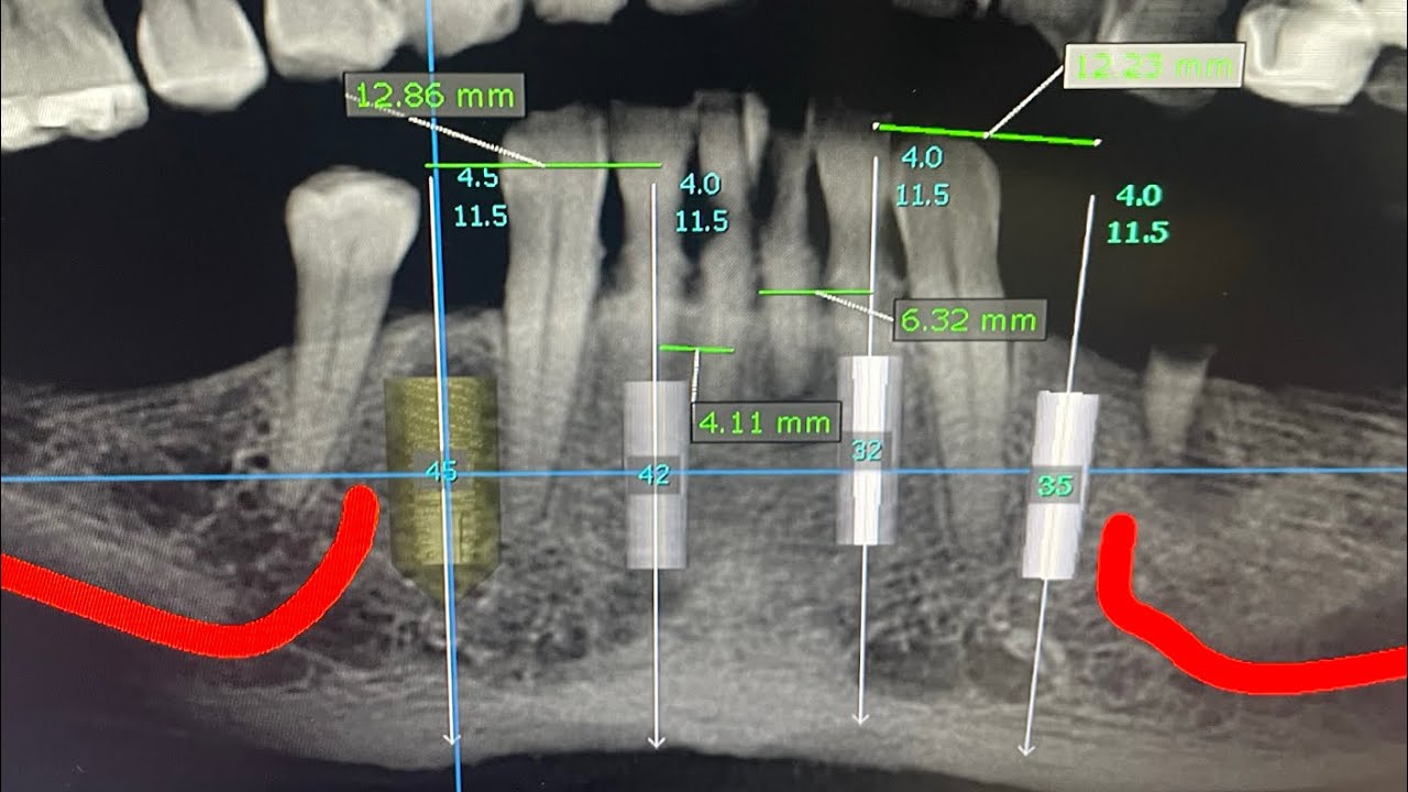Josué Márquez Gómez-226