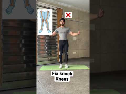 Knock knee Workout | Saurabh Fitness | #youtubeshorts #shorts
