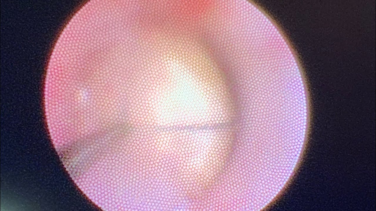 Giulianno Molina De Melo-72