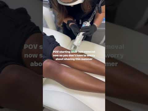 Laser hair removal results