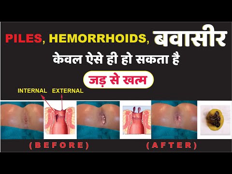 Pharma science ayurvedic piles care ayurvedic powder, 100 gm