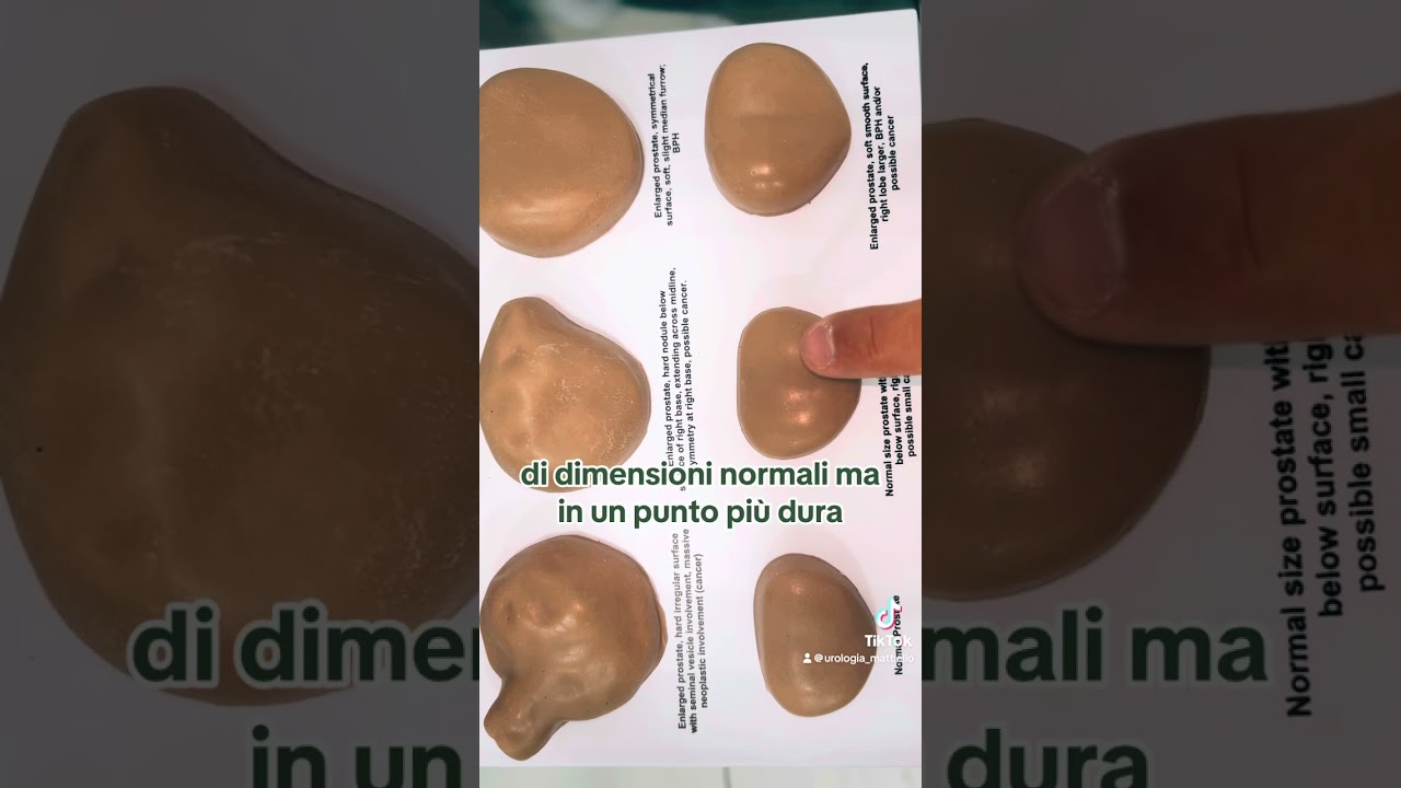 Gennaro Mattiello-22