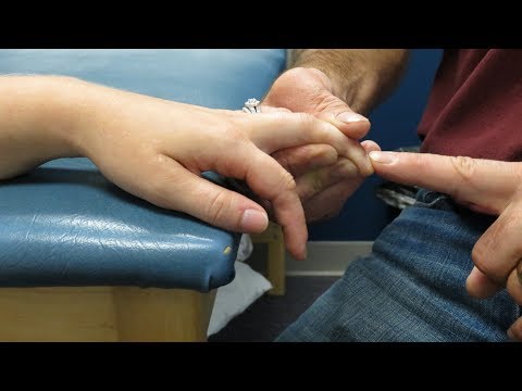 Hoffman s sign positive How to perform the test