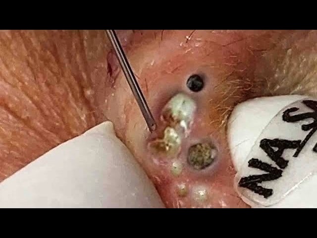 𝑺𝒐𝒐𝒕𝒉𝒊𝒏𝒈 𝑭𝒂𝒄𝒊𝒂𝒍 𝑻𝒓𝒆𝒂𝒕𝒎𝒆𝒏𝒕 𝑭𝒐𝒓 𝑺𝒕𝒓𝒆𝒔𝒔 𝑹𝒆𝒍𝒊𝒆𝒇 𝒂𝒕 𝑳𝒖𝒙𝒖𝒓𝒚 𝑺𝒑𝒂 𝑨𝒄𝒉𝒊𝒆𝒗𝒆 𝑰𝒏𝒏𝒆𝒓 𝑷𝒆𝒂𝒄𝒆 #5001333