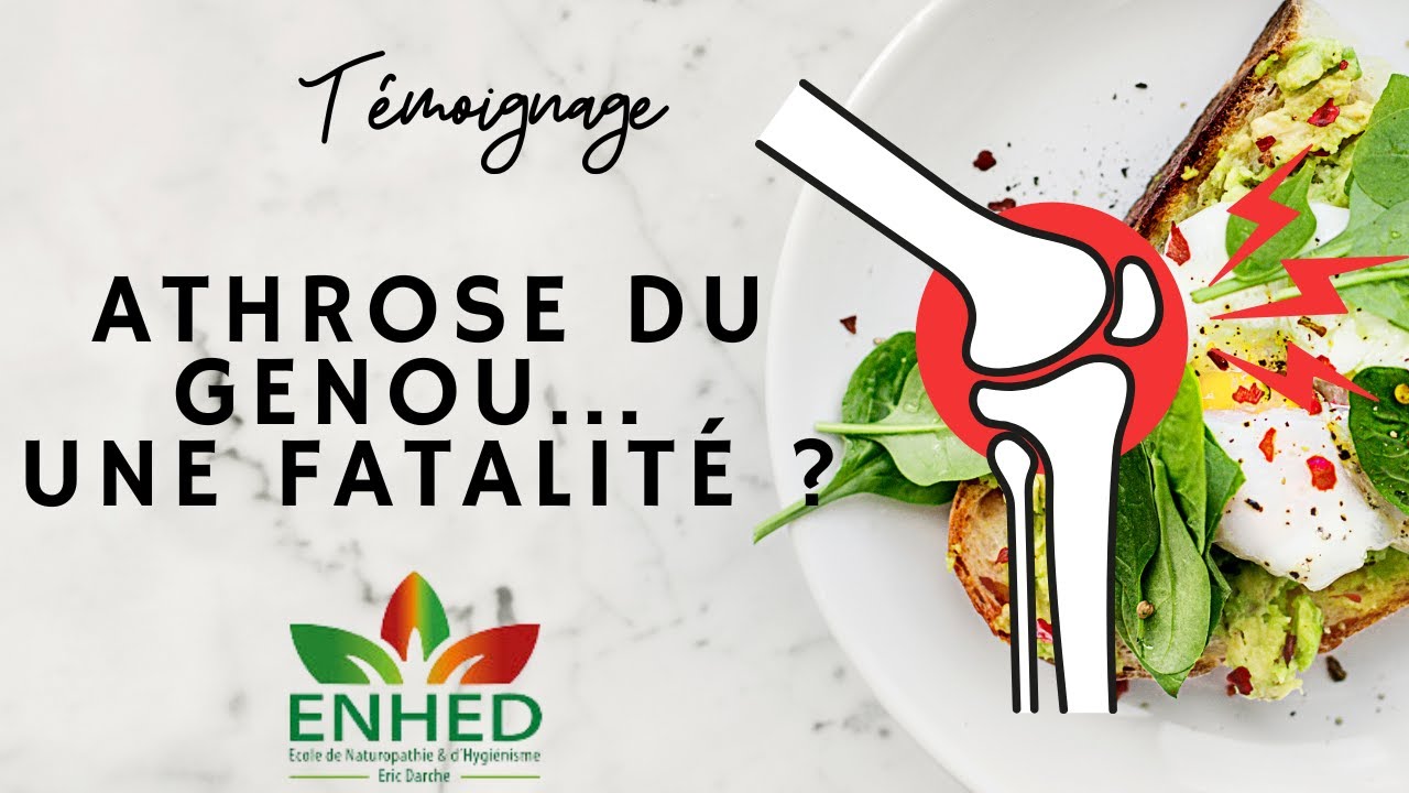 Témoignage et résultat Arthrose au genou