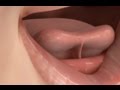 Tongue Tie Release Treatment