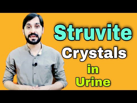Struvite Crystals in Urine | Struvite Stones | Causes | Diagnosis | Treatment