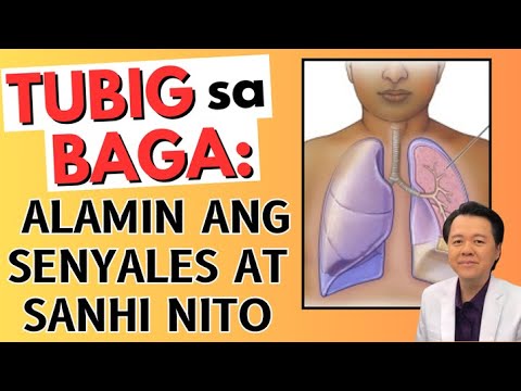 Tubig sa Baga: Alamin ang Senyales at Sanhi Nito. - By Doc Willie Ong (Internist and Cardiologist)