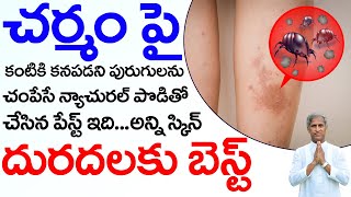 How to Cure Skin Allergy | How to Get Rid Of Skin Disease | Dr Manthena Satyanarayana Raju Videos