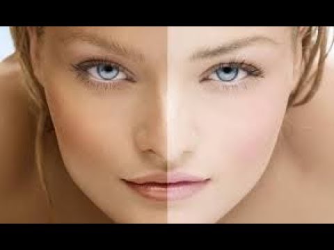 Tanorexia, cuando tomar el sol se vuelve una adicción «Maite Simeón»