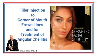 Filler Injection to Corner of Mouth Frown Lines and for Treatment of Angular Cheilitis.