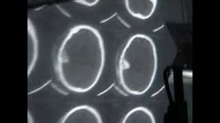 Neuro - 8 over all view on head injuries