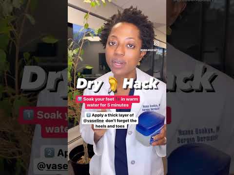 Unbelievable Trick to Get Rid of Dry Feet Instantly! #shorts