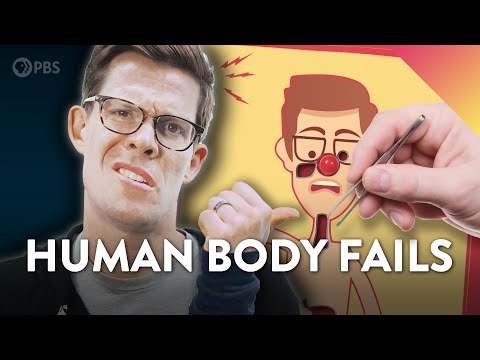 Evolution FAILS in the Human Body