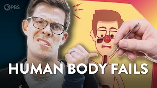Evolution FAILS in the Human Body
