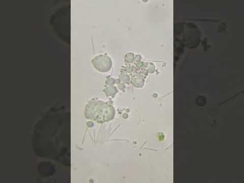 АНТИСЕПТИК VS МИКРОБЫ ПОД МИКРОСКОПОМ