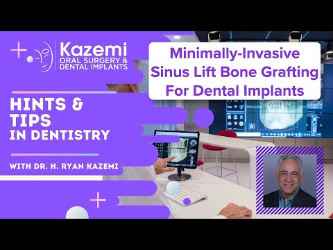 Minimally Invasive Sinus Lift Bone Grafting For Dental Implants
